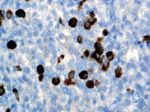 IHC of IgG on an FFPE Tonsil Tissue